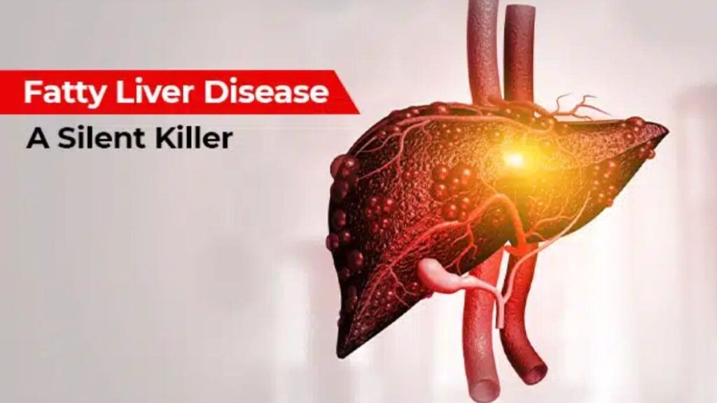 Doctor explains: How lifestyle choices & genetics fuel the alarming rise in fatty liver disease